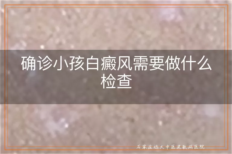 确诊小孩白癜风需要做什么检查