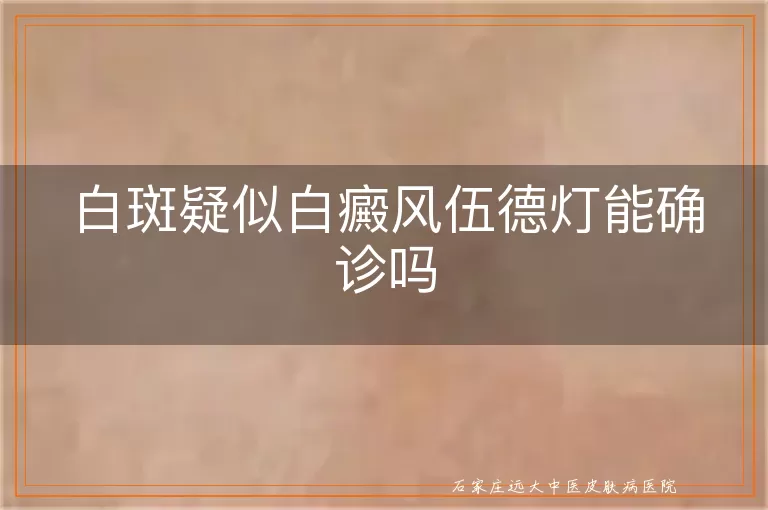 白斑疑似白癜风伍德灯能确诊吗
