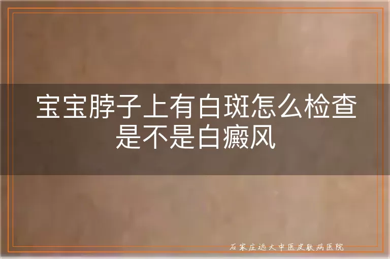 宝宝脖子上有白斑怎么检查是不是白癜风