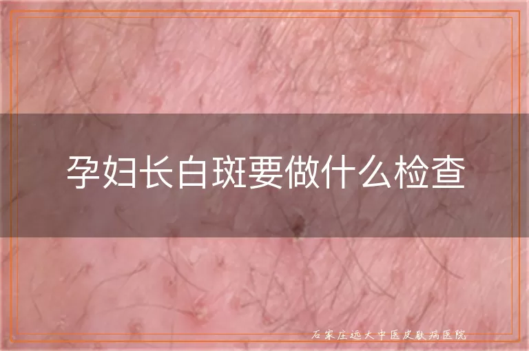 孕妇长白斑要做什么检查