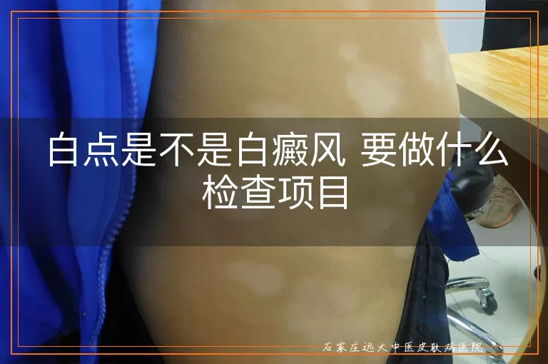 白点是不是白癜风 要做什么检查项目