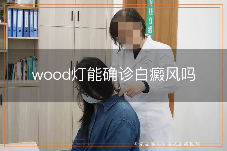 wood灯能确诊白癜风吗