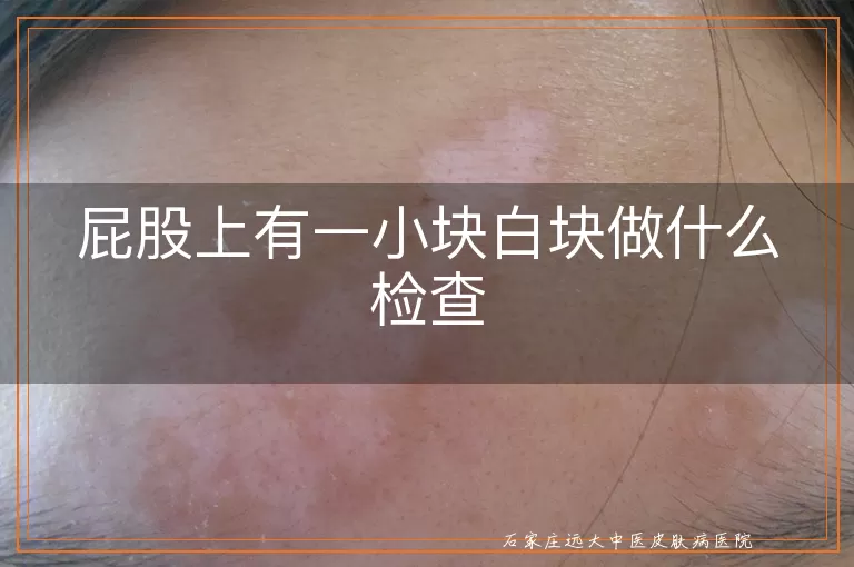 屁股上有一小块白块做什么检查