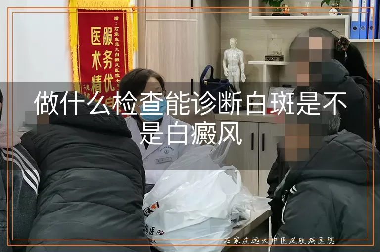 做什么检查能诊断白斑是不是白癜风