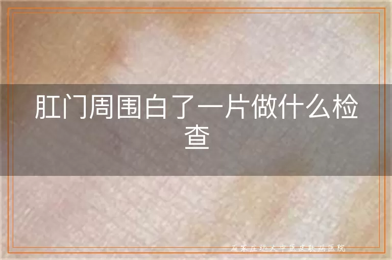 肛门周围白了一片做什么检查