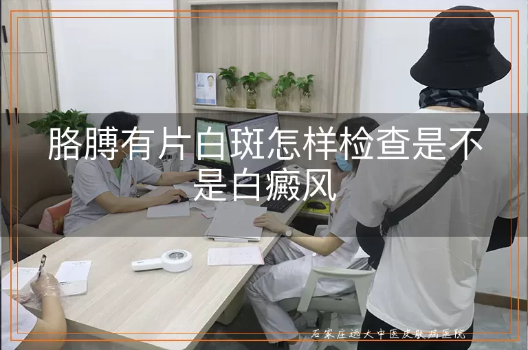胳膊有片白斑怎样检查是不是白癜风