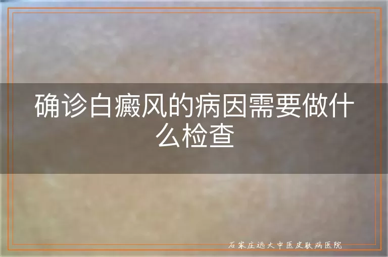 确诊白癜风的病因需要做什么检查