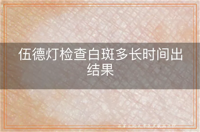 伍德灯检查白斑多长时间出结果