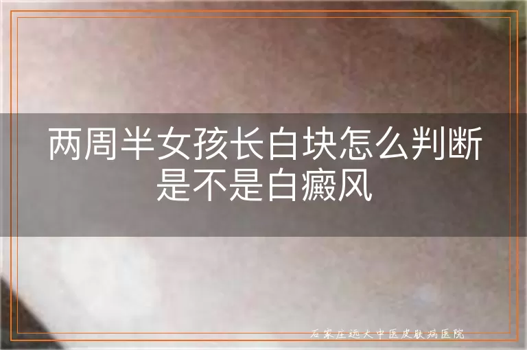 两周半女孩长白块怎么判断是不是白癜风