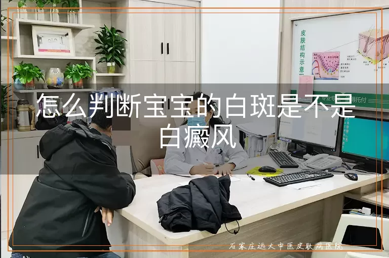 怎么判断宝宝的白斑是不是白癜风