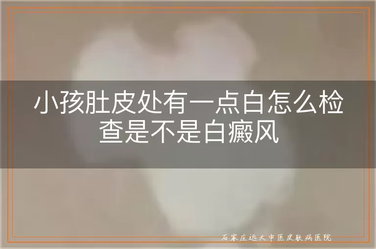 小孩肚皮处有一点白怎么检查是不是白癜风