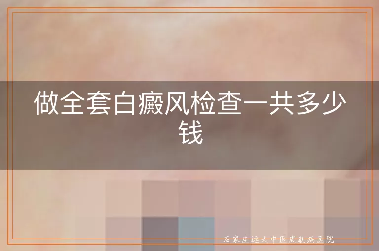 做全套白癜风检查一共多少钱