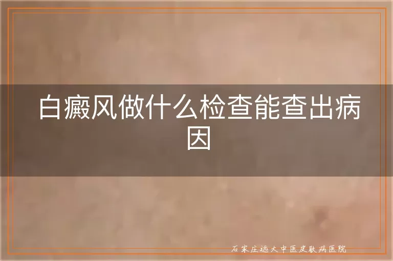 白癜风做什么检查能查出病因