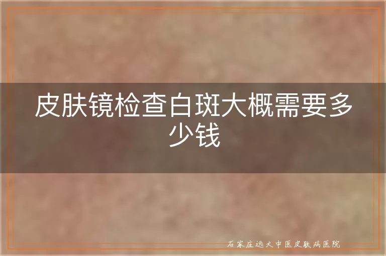 皮肤镜检查白斑大概需要多少钱