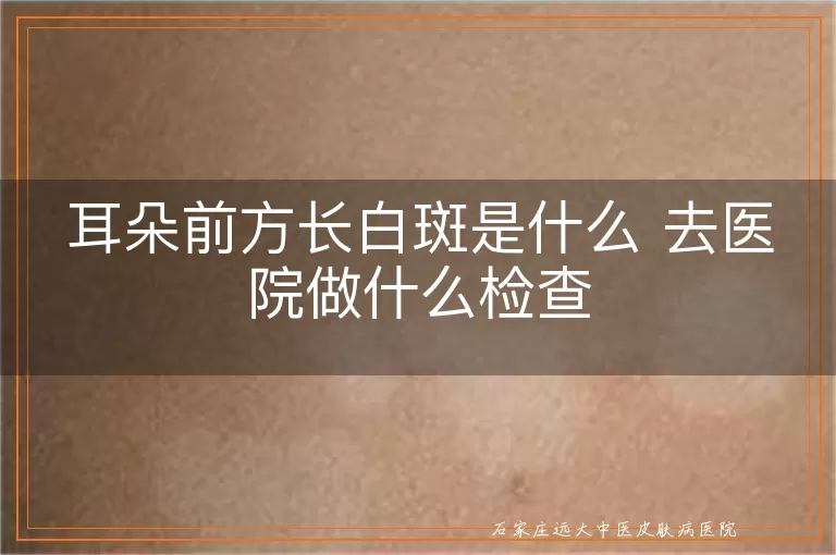 耳朵前方长白斑是什么 去医院做什么检查