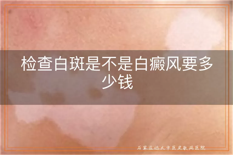 检查白斑是不是白癜风要多少钱
