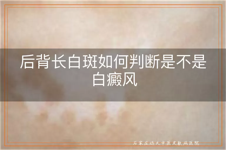 后背长白斑如何判断是不是白癜风