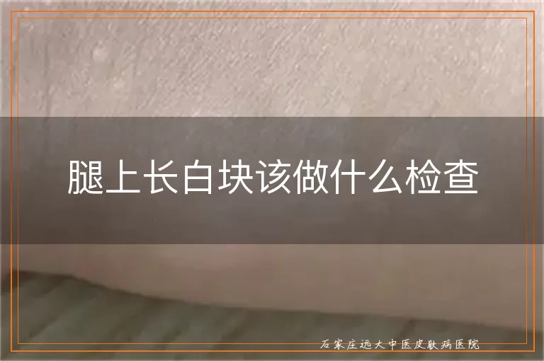腿上长白块该做什么检查