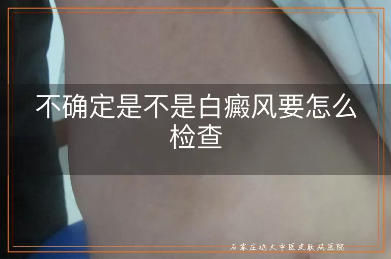 不确定是不是白癜风要怎么检查