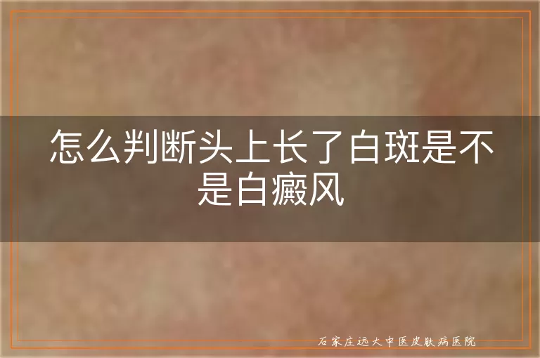 怎么判断头上长了白斑是不是白癜风