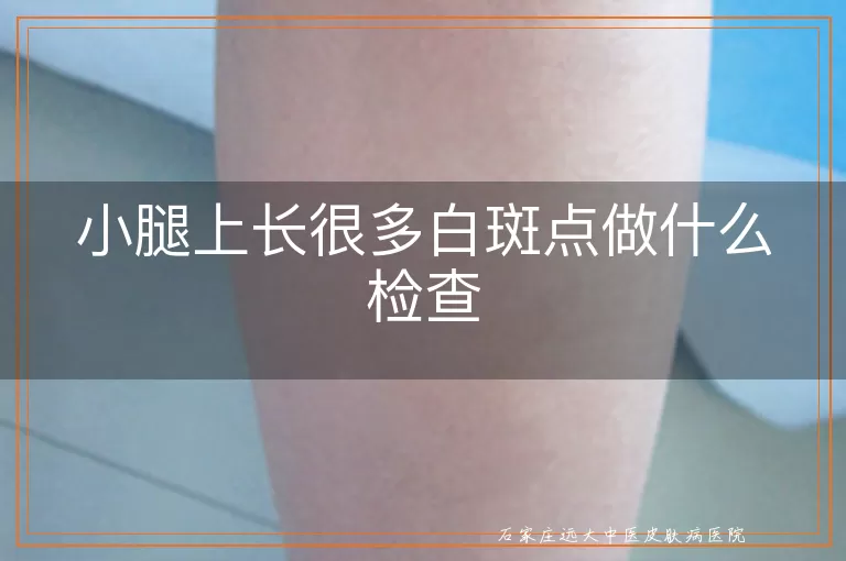 小腿上长很多白斑点做什么检查