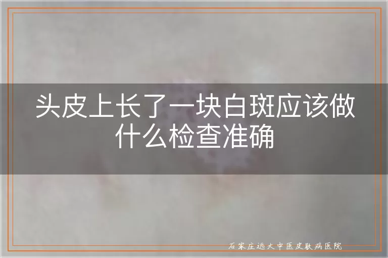 头皮上长了一块白斑应该做什么检查准确
