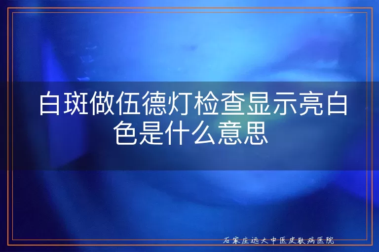 白斑做伍德灯检查显示亮白色是什么意思