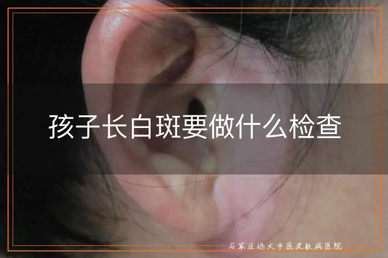 孩子长白斑要做什么检查
