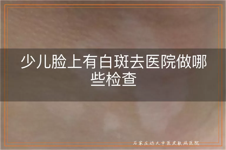少儿脸上有白斑去医院做哪些检查
