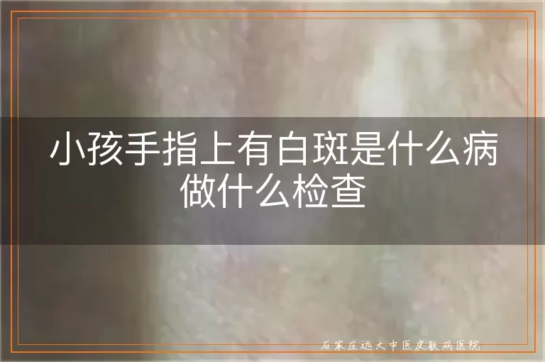 小孩手指上有白斑是什么病做什么检查