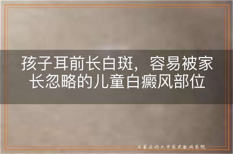 孩子耳前长白斑,容易被家长忽略的儿童白癜风部位