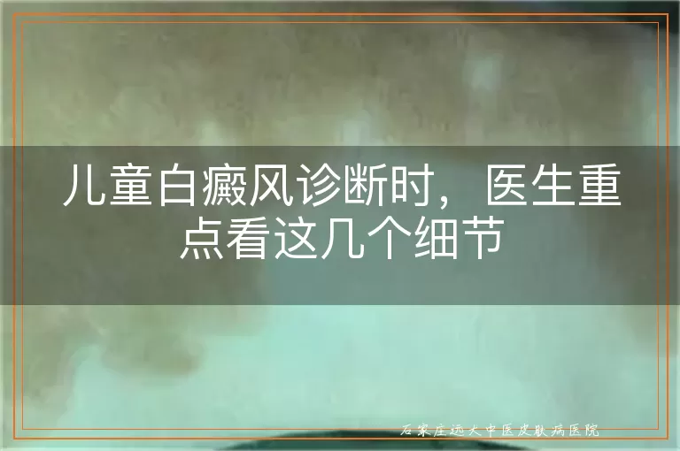 儿童白癜风诊断时,医生重点看这几个细节