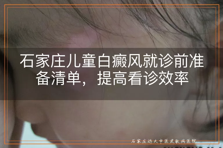 石家庄儿童白癜风就诊前准备清单，提高看诊效率