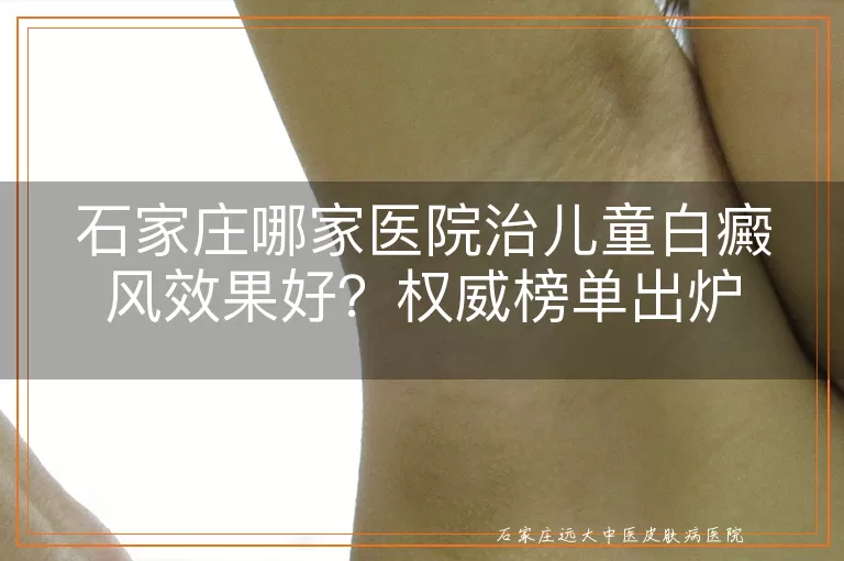 石家庄哪家医院治儿童白癜风效果好？权威榜单出炉