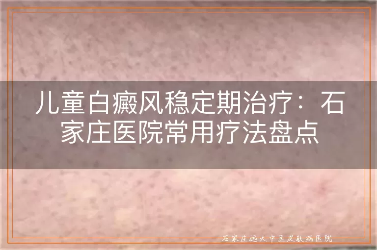 儿童白癜风稳定期治疗：石家庄医院常用疗法盘点
