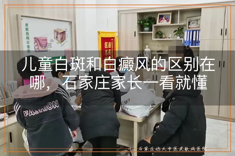 儿童白斑和白癜风的区别在哪，石家庄家长一看就懂