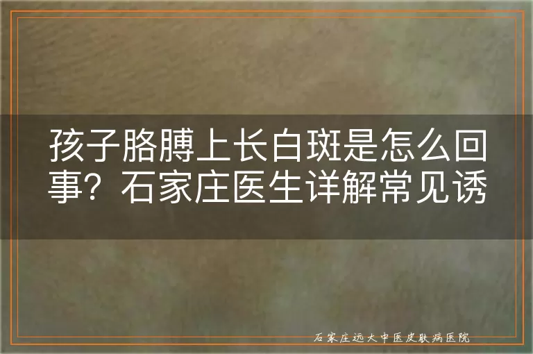 孩子胳膊上长白斑是怎么回事？石家庄医生详解常见诱因