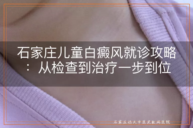 石家庄儿童白癜风就诊攻略:从检查到治疗一步到位