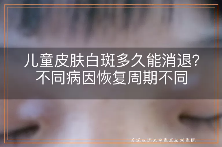 儿童皮肤白斑多久能消退?不同病因恢复周期不同
