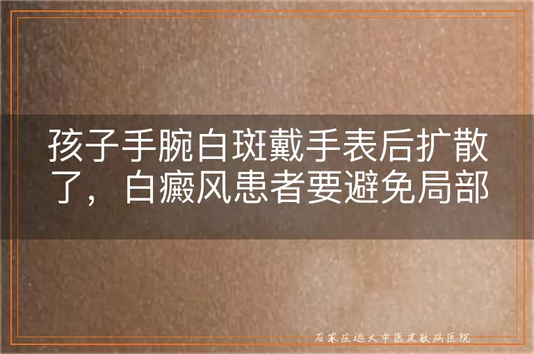 孩子手腕白斑戴手表后扩散了，白癜风患者要避免局部摩擦