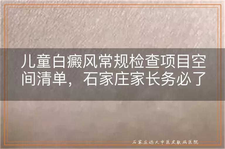 儿童白癜风常规检查项目空间清单，石家庄家长务必了解