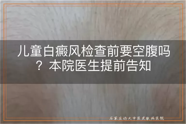 儿童白癜风检查前要空腹吗？本院医生提前告知