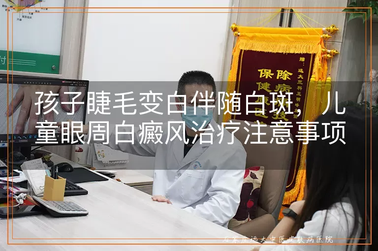 孩子睫毛变白伴随白斑，儿童眼周白癜风治疗注意事项