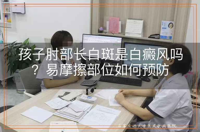 孩子肘部长白斑是白癜风吗？易摩擦部位如何预防