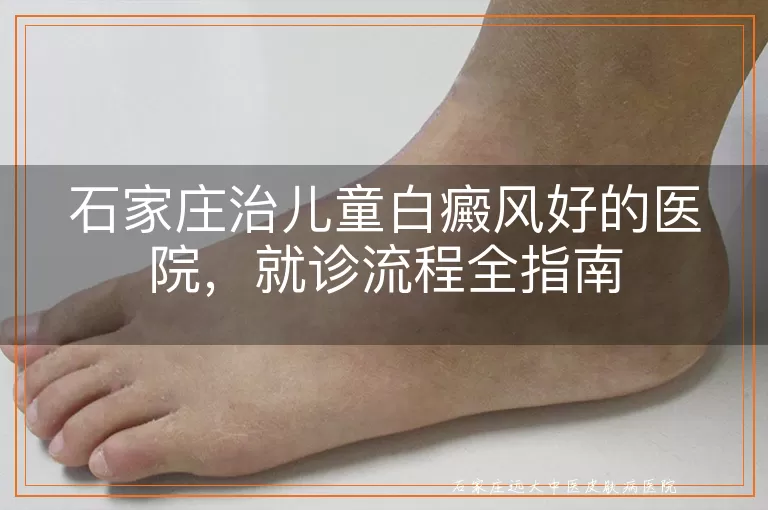 石家庄治儿童白癜风好的医院，就诊流程全指南
