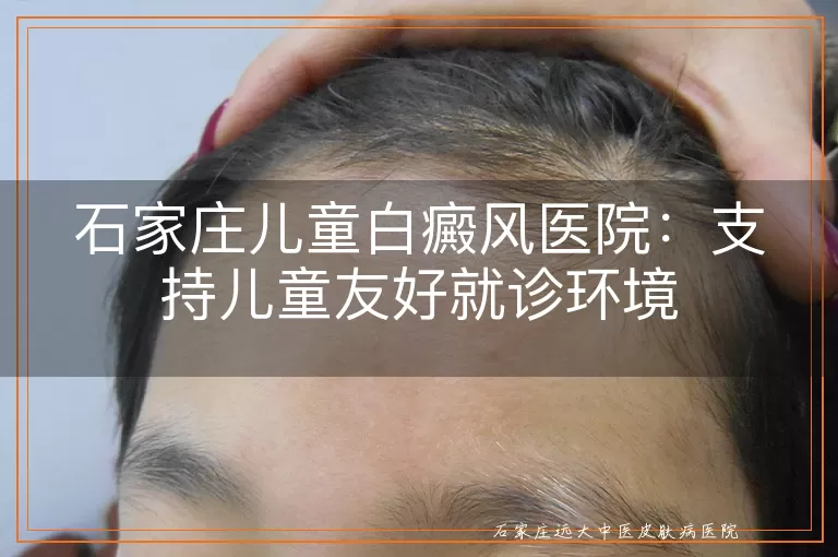 石家庄儿童白癜风医院：支持儿童友好就诊环境