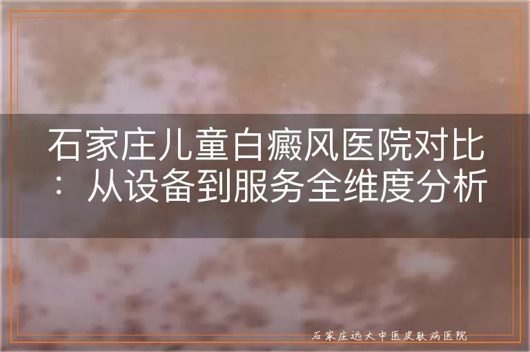 石家庄儿童白癜风医院对比：从设备到服务全维度分析