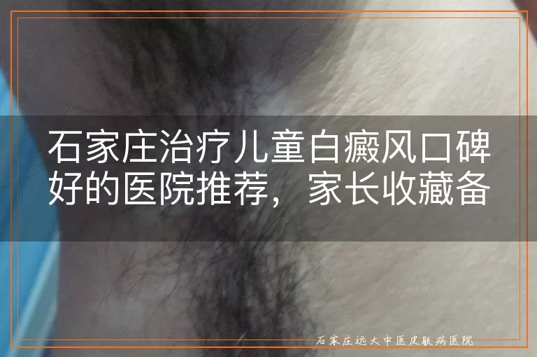 石家庄治疗儿童白癜风口碑好的医院推荐，家长收藏备用