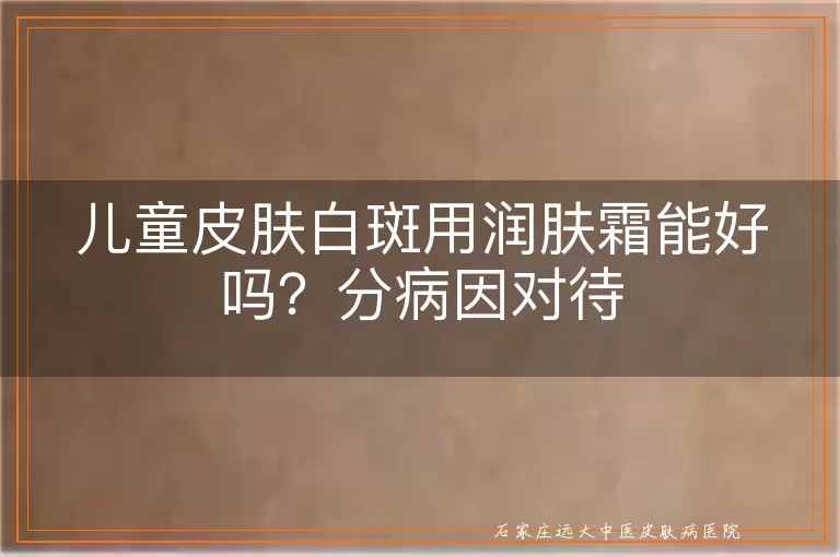 儿童皮肤白斑用润肤霜能好吗？分病因对待