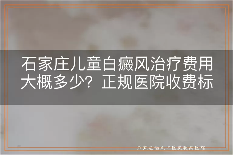 石家庄儿童白癜风治疗费用大概多少？正规医院收费标准公开